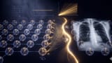 Quantum Kernel Advantage over Classical Collapse