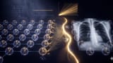 Quantum Kernel Advantage over Classical Collapse