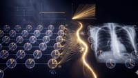 Quantum Kernel Advantage over Classical Collapse